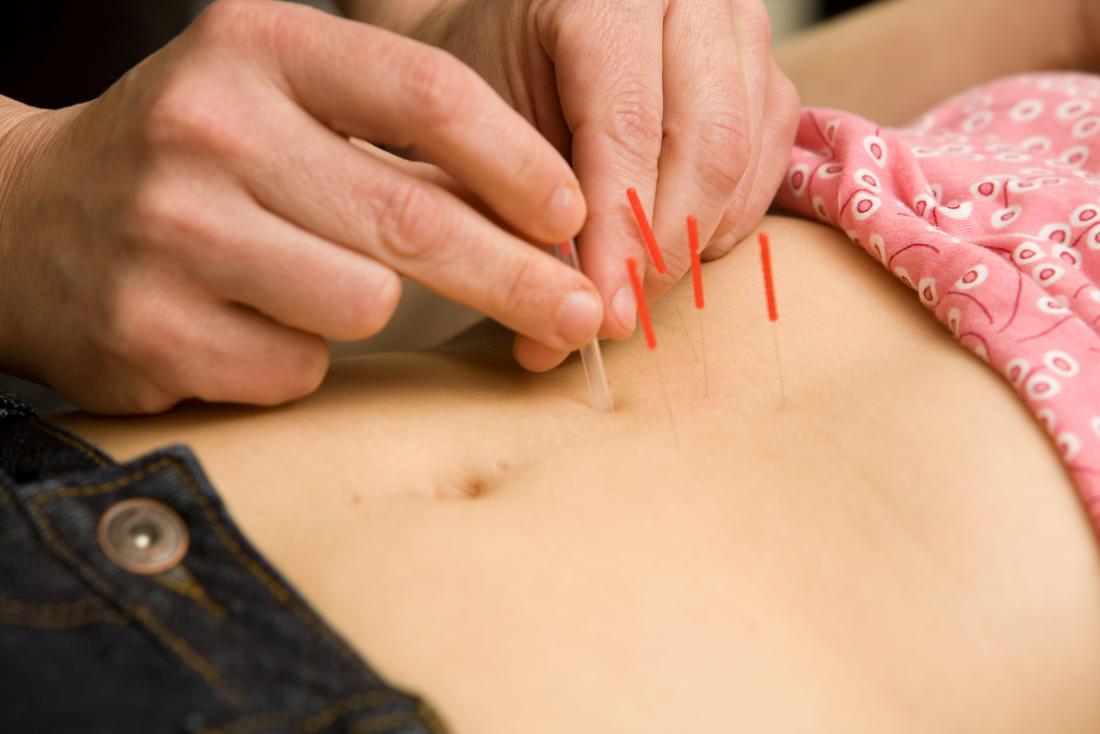 acupuncture-stomach