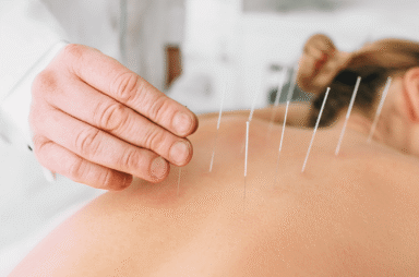 Acupuncture for Chronic Pain Management Treatment